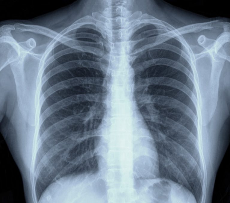 Radiographie au cabinet de radiologie du Piémont à Obernai